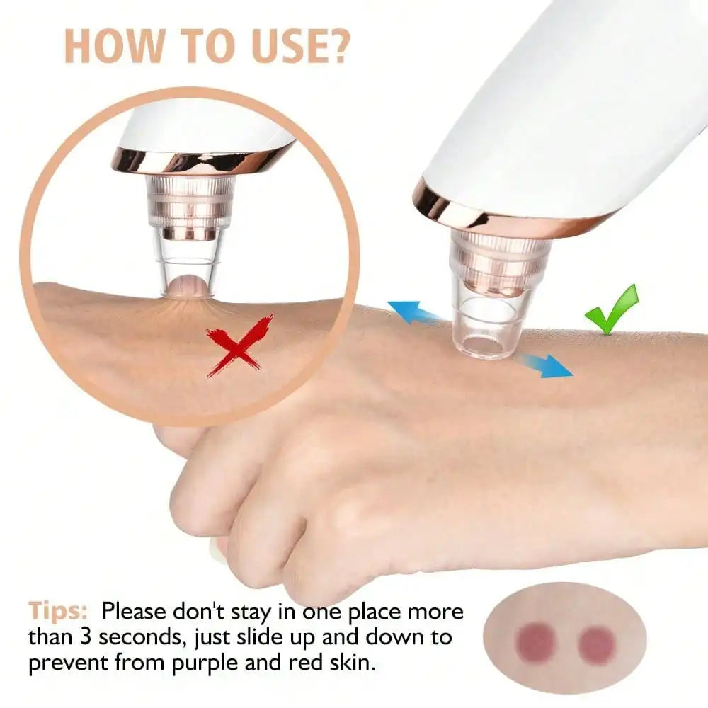 Blackhead Remover Pore Vacuum Acne Cleaner Black Spots Removal Facial Deep Cleansing Pore Cleaner Machine Skin Care Tools