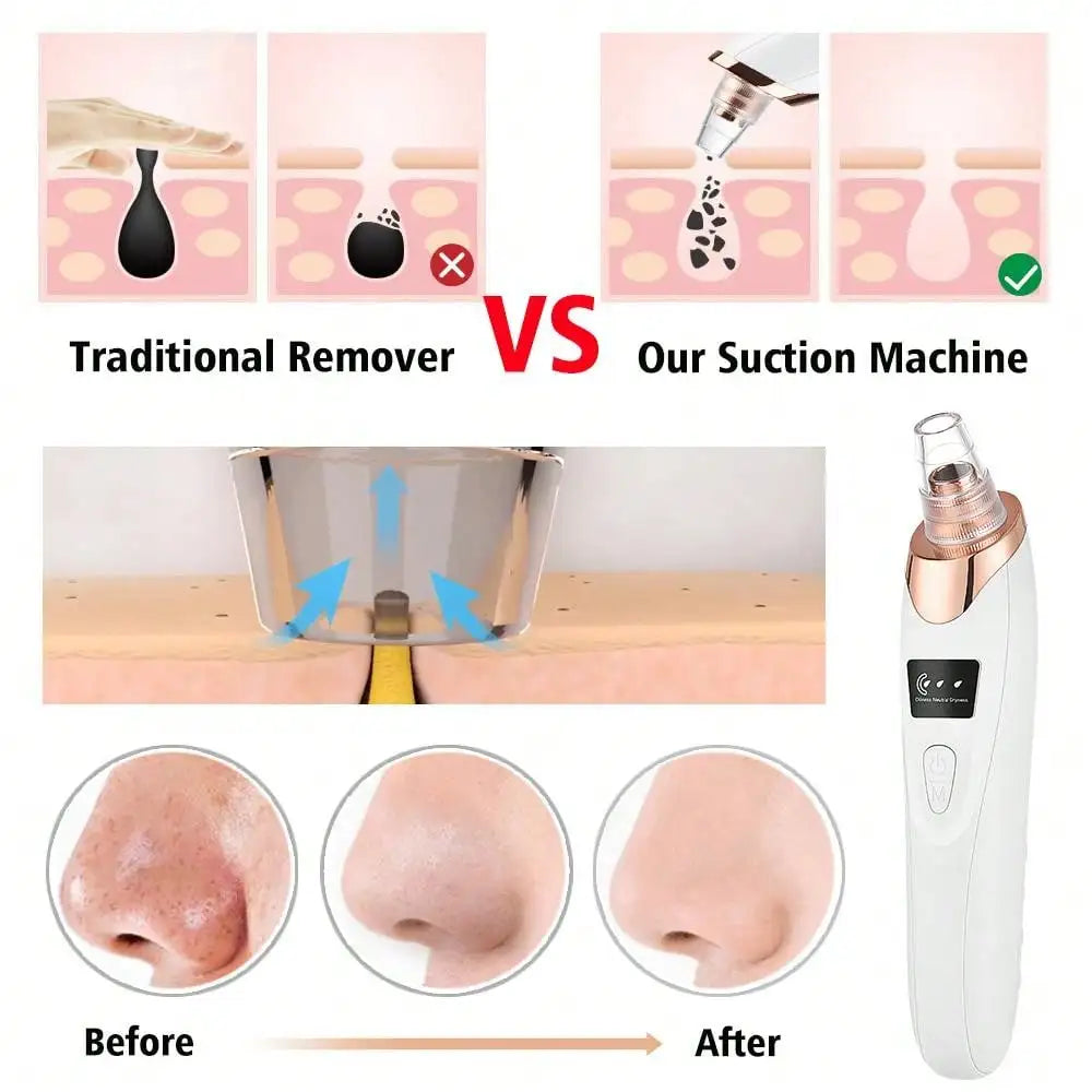 Blackhead Remover Pore Vacuum Acne Cleaner Black Spots Removal Facial Deep Cleansing Pore Cleaner Machine Skin Care Tools